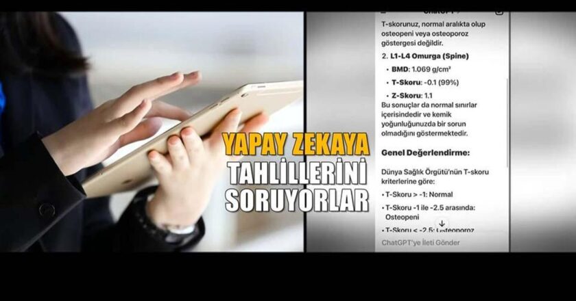 Şimdi Dr. Yapay Zeka Tehlikesi: Hatta ondan analiz istiyorlar! – Sağlık Haberleri
