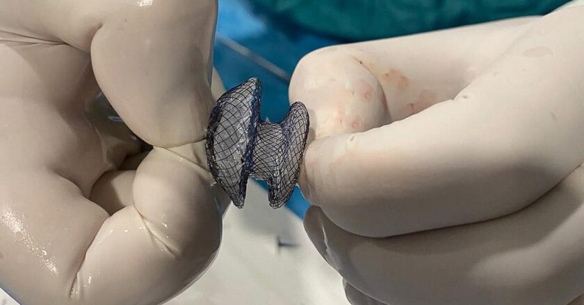 Çarpıntı, nefes darlığı ve yorgunluk varsa dikkat! Kalp deliği artık kapalı yöntemle tedavi edilebiliyor