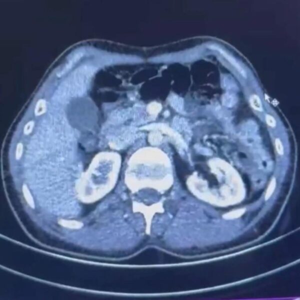 Üç İranlı röntgen cihazında yakalandı!