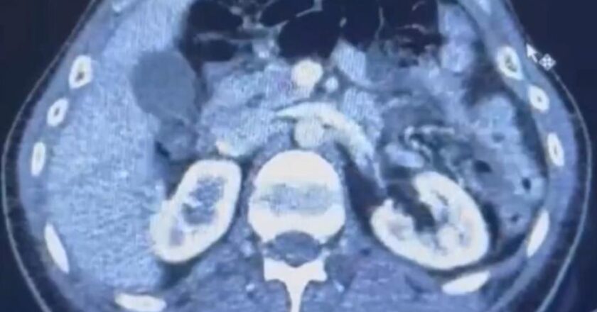 Üç İranlı röntgen cihazında yakalandı!